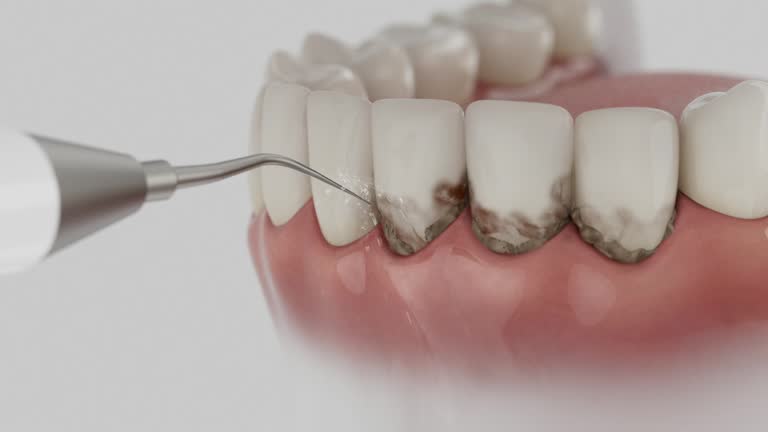 Reliable Dental Implants contractor in Nederland, TX by Smile Center Dentistry